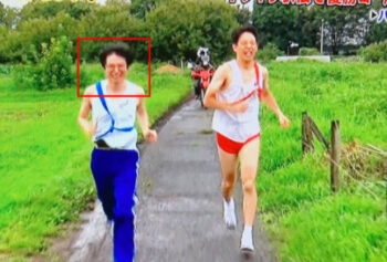 水川かたまりさんのハゲ